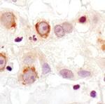 PDHA1 Antibody in Immunohistochemistry (Paraffin) (IHC (P))