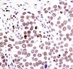 PSIP1 Antibody in Immunohistochemistry (Paraffin) (IHC (P))