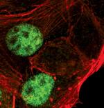 Progesterone Receptor Antibody in Immunocytochemistry (ICC/IF)