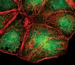 FOXO1 Antibody in Immunocytochemistry (ICC/IF)