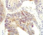 FAS Antibody in Immunohistochemistry (Paraffin) (IHC (P))