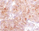 FASN Antibody in Immunohistochemistry (Paraffin) (IHC (P))