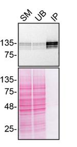 SHIP1 Antibody in Immunoprecipitation (IP)