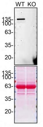 SHIP1 Antibody in Western Blot (WB)