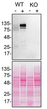 SHIP1 Antibody in Western Blot (WB)