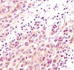 AKT Pan Antibody in Immunohistochemistry (Paraffin) (IHC (P))