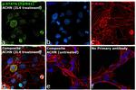 Phospho-STAT6 (Tyr641) Antibody in Immunocytochemistry (ICC/IF)