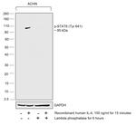 Phospho-STAT6 (Tyr641) Antibody