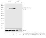 Phospho-STAT6 (Tyr641) Antibody in Western Blot (WB)