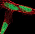 SUMO2/SUMO3 Antibody in Immunocytochemistry (ICC/IF)