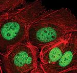 SETDB1 Antibody in Immunocytochemistry (ICC/IF)