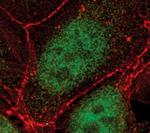 TCF7 Antibody in Immunocytochemistry (ICC/IF)