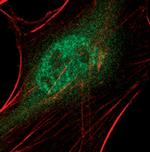 DAXX Antibody in Immunocytochemistry (ICC/IF)