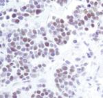 HP1 alpha Antibody in Immunohistochemistry (Paraffin) (IHC (P))