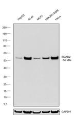 SMAD2 Antibody in Western Blot (WB)