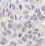 AKT Pan Antibody in Immunohistochemistry (Paraffin) (IHC (P))