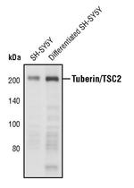 TSC2 Antibody in Western Blot (WB)