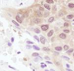 4EBP1 Antibody in Immunohistochemistry (Paraffin) (IHC (P))