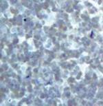 DRAK2 Antibody in Immunohistochemistry (Paraffin) (IHC (P))