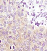 GYS1 Antibody in Immunohistochemistry (Paraffin) (IHC (P))