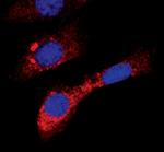 Acetyl-CoA Carboxylase Antibody in Immunocytochemistry (ICC/IF)