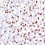 PU.1 Antibody in Immunohistochemistry (Paraffin) (IHC (P))