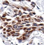 NFkB p52 Antibody in Immunohistochemistry (Paraffin) (IHC (P))