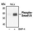 Phospho-SMAD1/SMAD5 (Ser463, Ser465) Antibody in Western Blot (WB)
