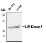 LIMK2 Antibody in Western Blot (WB)