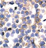 Phospho-CSF1R (Tyr723) Antibody in Immunohistochemistry (Paraffin) (IHC (P))