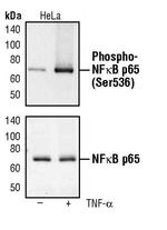 Phospho-NFkB p65 (Ser536) Antibody in Western Blot (WB)