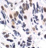 Phospho-p38 MAPK alpha (Thr180, Tyr182) Antibody in Immunohistochemistry (Paraffin) (IHC (P))