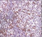 Zap-70 Antibody in Immunohistochemistry (Paraffin) (IHC (P))