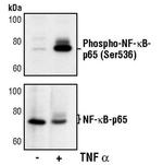 Phospho-NFkB p65 (Ser536) Antibody