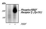 Phospho-PDGFRB (Tyr751) Antibody in Western Blot (WB)