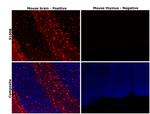 S100B Antibody in Immunohistochemistry (Paraffin) (IHC (P))