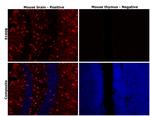 S100B Antibody in Immunohistochemistry (Paraffin) (IHC (P))