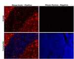 S100B Antibody in Immunohistochemistry (Paraffin) (IHC (P))