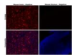 S100B Antibody