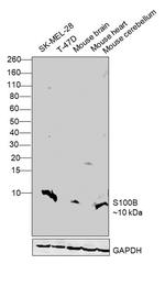 S100B Antibody in Western Blot (WB)