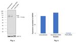 Progesterone Receptor Antibody in Western Blot (WB)