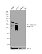 Cytokeratin Pan Antibody