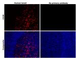 CD38 Antibody in Immunohistochemistry (Paraffin) (IHC (P))