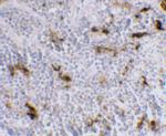 DC-SIGN Antibody in Immunohistochemistry (IHC)