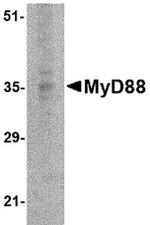 MyD88 Antibody in Western Blot (WB)