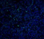 PD-1 Antibody in Immunohistochemistry (IHC)