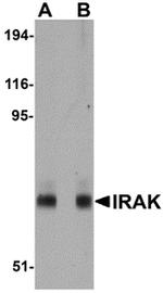 IRAK1 Antibody in Western Blot (WB)