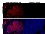 c-Kit Antibody in Immunohistochemistry (Paraffin) (IHC (P))