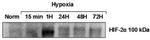 HIF-2 alpha Antibody in Western Blot (WB)