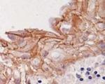 Desmoglein 3 Antibody in Immunohistochemistry (Paraffin) (IHC (P))